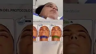 Tratamiento facial HIFU Liftera