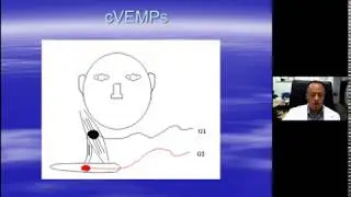 VEMP with Dr. Eleftherios Papathanasiou (part 1 of 4)