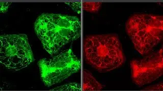 New genetic link found for some forms of SIDS