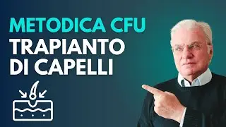 La metodica CFU per il trapianto di capelli con tecnica FUT