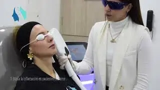 IPL (luz pulsada intensa)