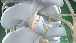 Facet Joint Syndrome Reasons