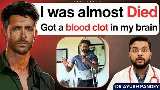 How Hrithik Roshan Survived A Deadly Brain Injury On A Movie Shoot? | Doctor Explains Truth😱