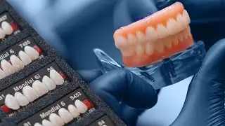 How I Started To Love My Smile Again Thanks To ClearChoice