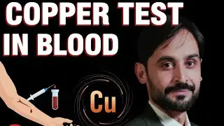 Copper Test in Blood | Serum Copper Levels, Indications, Interpretation & Wilson&rsquo;s Disease