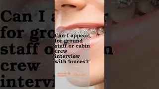 Criteria for braces in cabin crew/ground staff interviews| watch till end