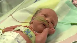 Continuous Regional Analysis Device for neonate Lung CRADL