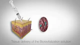 Video abstract In vitro study  Skinbooster RRS HA injectable   Skin Tech
