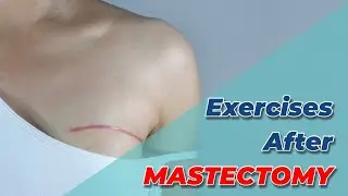 Exercises after post mastectomy best post mastectomy exercises post mastectomy recovery exercises