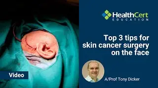 Top 3 tips for skin cancer surgery on the face | A/Prof Tony Dicker