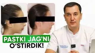 Notekis Tishlarni To'g'irlashni Eng Oson Yo'li | Keys Tahlili