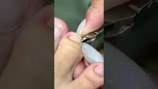 CRAZY Thick Cuticles Removal ep27 #amazing #cleaningenthusiast #nails #trending #viralvideo 