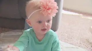 Dad Calls Colorado Baby Born With Rare Birth Defect 'A Little Rock Star'