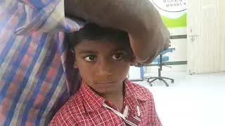 Bilateral Behind the ear hearing aid in congenital deaf