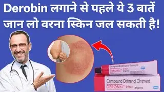 Derobin Ointment लगाने का सही तरीका | Side Effects और Precautions जरूर जानें!