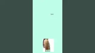 Transgender Breast Augmentation Before and After Result #transgender #boobs