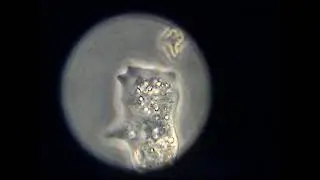 Leben im Wassertropfen