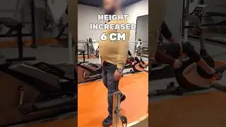 Limb Lengthening Surgery Recovery Status In 7 months | Height Increase Surgery India #heightsurgery