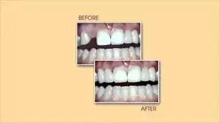 Dentist Central London Colborne Family Dentistry