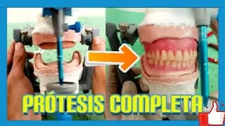 🔵 Como se hace una dentadura o  PRÓTESIS DENTAL completa ✅