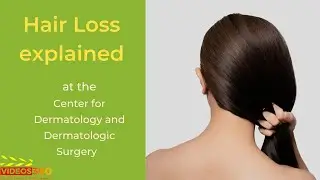 Hair Loss explained by Dr. Cheryl Burgess