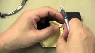 ワイヤークラスプの屈曲 ２
