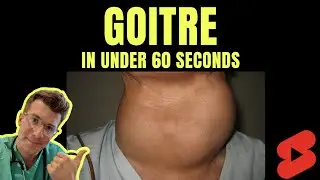 Doctor explains GOITRE in under 60 seconds - SYMPTOMS, TREATMENT & MORE #shorts #medical #health