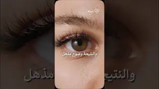 كيف تعمل قطرة VIZZ على تحسين الرؤية القريبة بسرعة وأمان؟