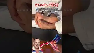 heel 👠 pain relief... #duet #fascitis #doctor #feet #excersice #short #viral #yog #fat #pain