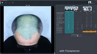 TrichoLAB @ FotoFinder Australia