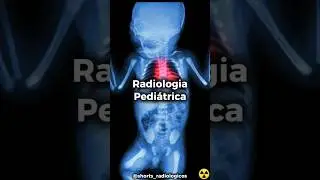 ☢️ RADIOLOGIA PEDI&Aacute;TRICA 👀 #raiox #curiosidades #shorts #radiologia