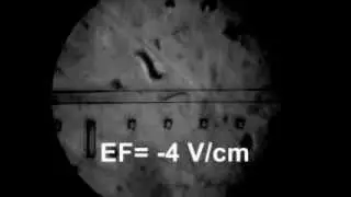 Electrotaxis - normal worm
