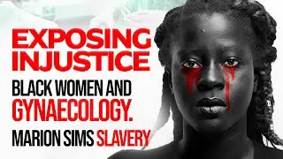 Gynecology And Black Women: The J. Marion Sims Enslaved Experiment