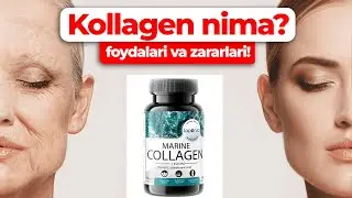 Kollagen nima? Foydalari va zararlari!