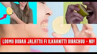 LOOMII FOOLII GAARIIF BOBAA JALATTI DIBACHUU FI ILKAAN ADDEESSUUF ILKAANITTI RIGUU ILAALCHISEE