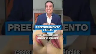 Aprenda o PREENCHIMENTO LABIAL PERFEITO para 2026 SEM ERROS! VEJA AQUI