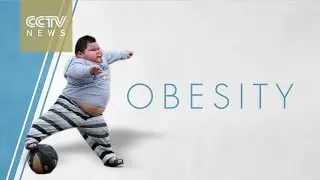 Discussion: The global&nbsp;obesity&nbsp;epidemic