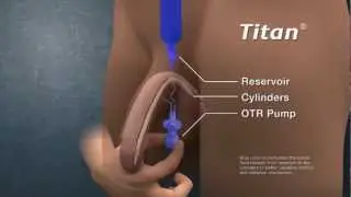 Titan_Animation