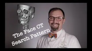 CT Face Search Pattern