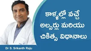 Types of Leg Ulcers and Treatment in Telugu | Venous Ulcer | Arterial Ulcer | Diabetic Foot Ulcer