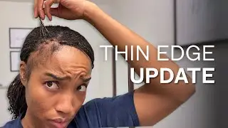 The Ugly Pre-Retightening Phase | Microlocs, Thin Edges, Growth & Loc Extensions 
