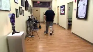 Below Knee Amputee Walking After One Week on New Prosthesis