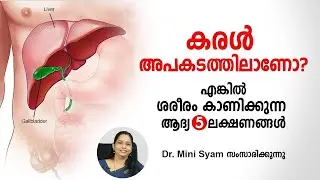 Is Your Liver in Danger? | Early Signs of Liver Damage You Should Not Ignore