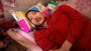 My Shocking Story - Giant Prognosis