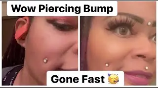 How To Get Rid Of A Piercing Bump Fast      #NykkiParker #PiercingBump #KeloidBump