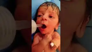 Infant feeding Just after birth by nipple #babyshorts #love #newbornbaby#babyfeed#cutebabies