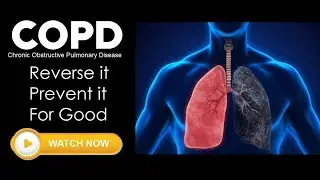 COPD, Chronic Obstructive Pulmonary Disease, Reverse it Prevent it For Good