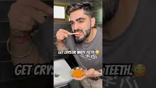 Cure your Yellow teeth and Get crystal white teeth.😳 DIY remedy for yellow teeth.💯