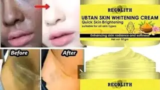 Rigolith uptan skin whitening cream Quick skin brightening cream review