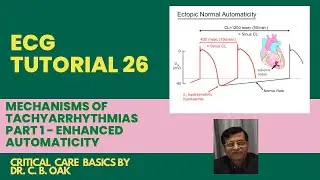 ECG Tutorial 26 Mechanisms of tachyarrhythmias Part 1- Enhanced automaticity